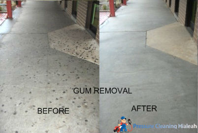 Gum Removal South Florida | Pressure Cleaning Hialeah